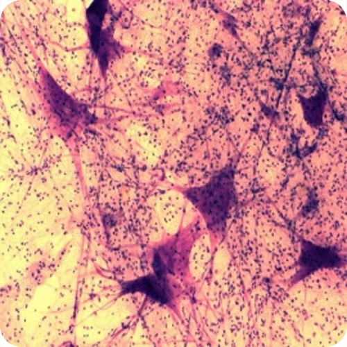 신경세포슬라이드-뉴런