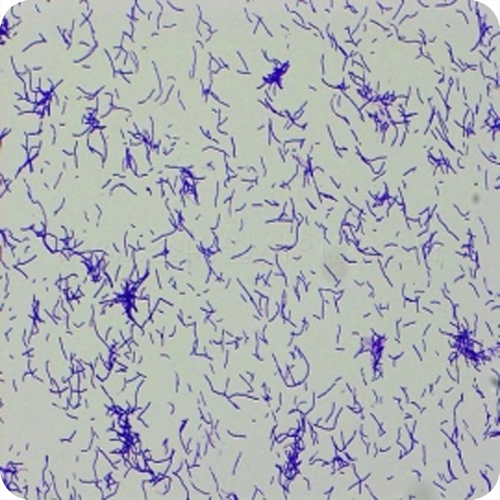 간균(Gram Positive Bacillus)