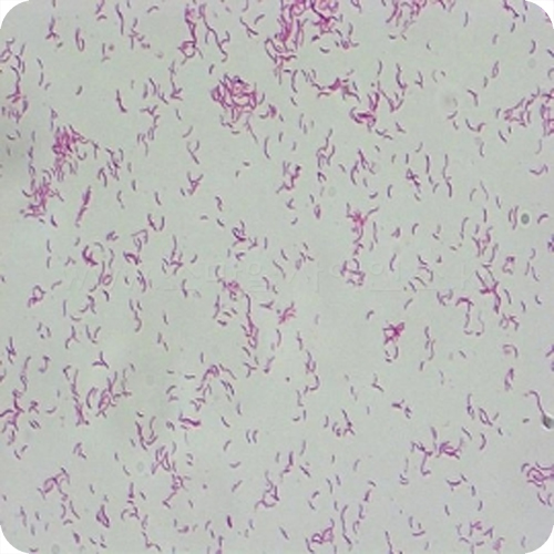 나선균(Typical Spirillum)