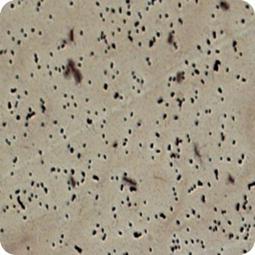 박테리아편모충(Bacterial Flagella)